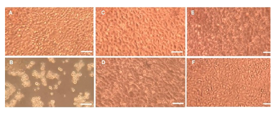 fortune-biomass-feedstock