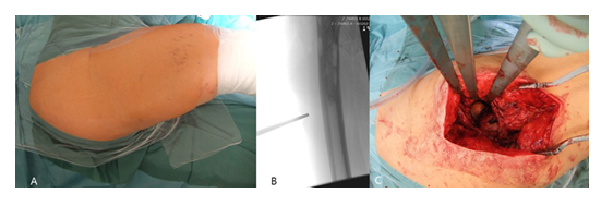 fortune-biomass-feedstock