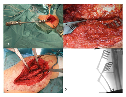 fortune-biomass-feedstock