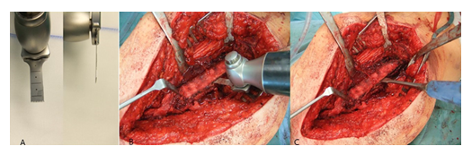 fortune-biomass-feedstock