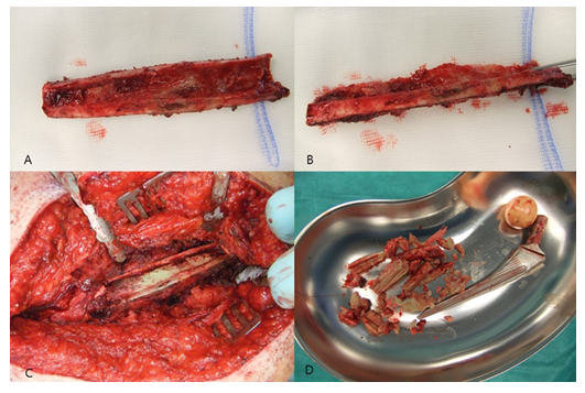 fortune-biomass-feedstock