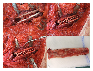 fortune-biomass-feedstock