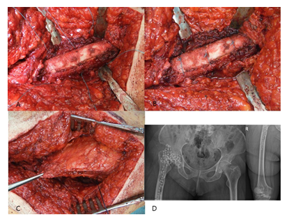 fortune-biomass-feedstock