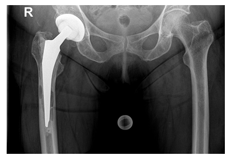 fortune-biomass-feedstock