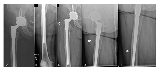 fortune-biomass-feedstock