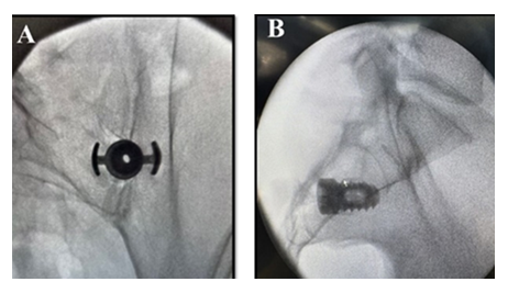 fortune-biomass-feedstock fortune-biomass-feedstock