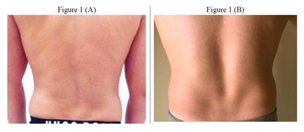 fortune-biomass-feedstock