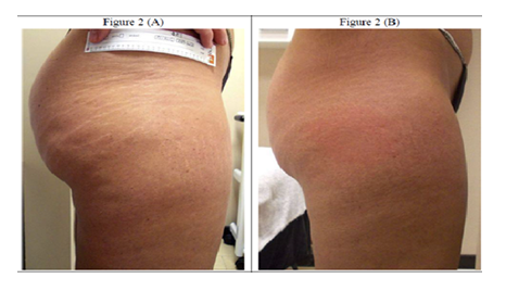 fortune-biomass-feedstock