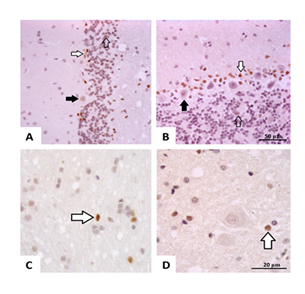fortune-biomass-feedstock