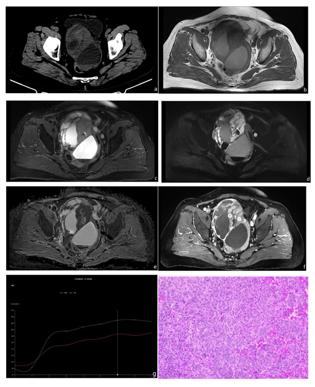 fortune-biomass-feedstock