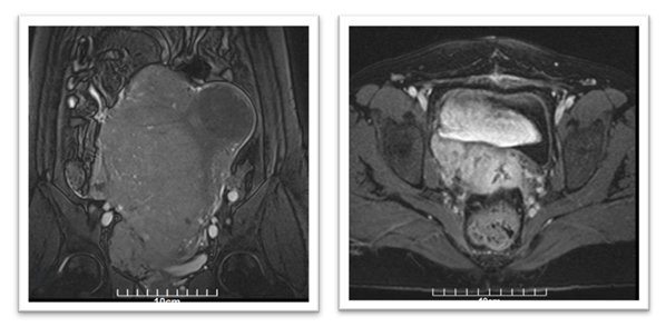 fortune-biomass-feedstock fortune-biomass-feedstock