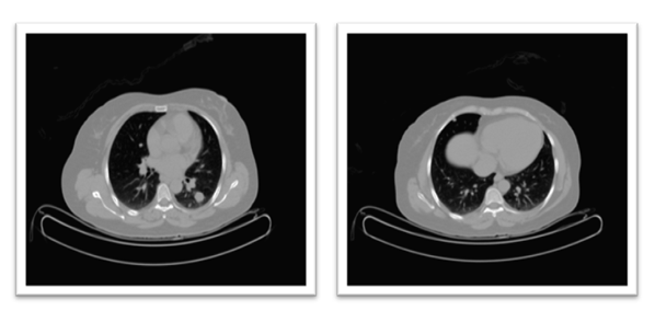 fortune-biomass-feedstock fortune-biomass-feedstock