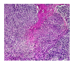fortune-biomass-feedstock fortune-biomass-feedstock