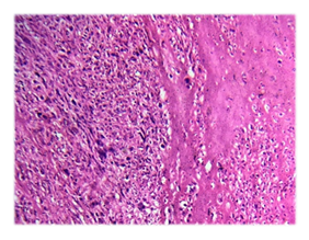 fortune-biomass-feedstock fortune-biomass-feedstock