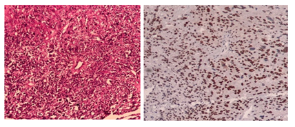 fortune-biomass-feedstock fortune-biomass-feedstock