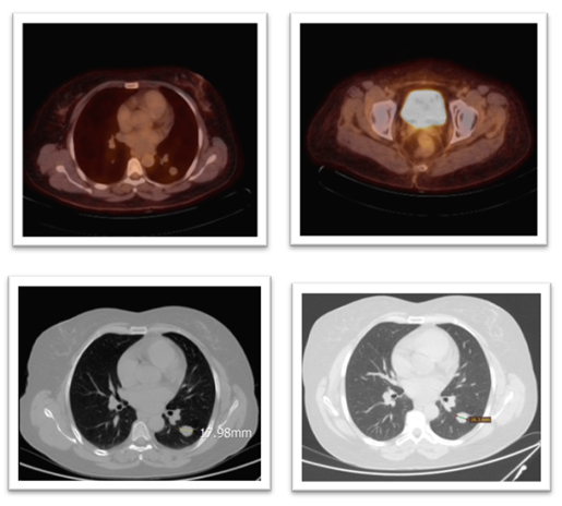 fortune-biomass-feedstock fortune-biomass-feedstock