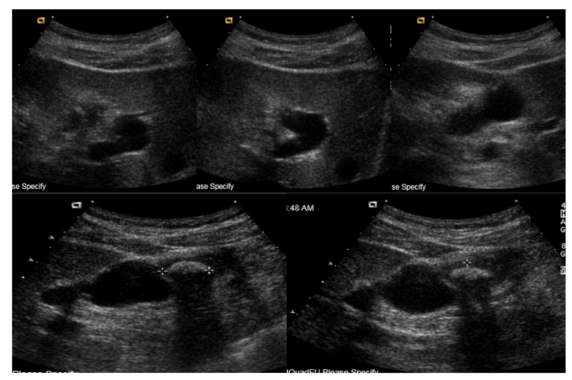 fortune-biomass-feedstock