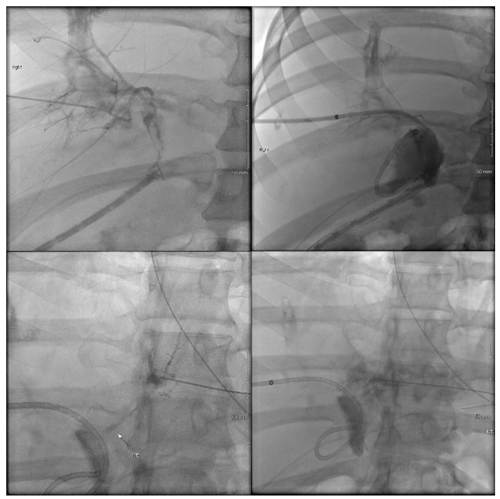 fortune-biomass-feedstock