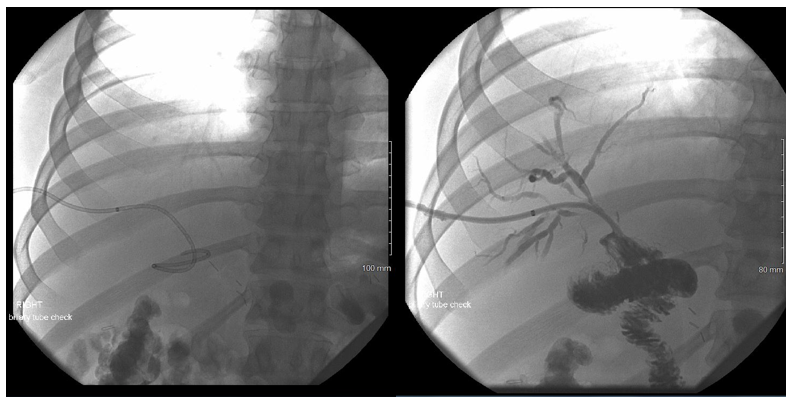 fortune-biomass-feedstock