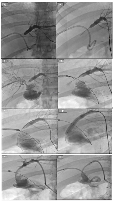 fortune-biomass-feedstock