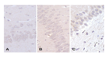 fortune-biomass-feedstock