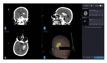 fortune-biomass-feedstock