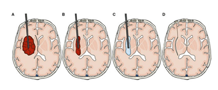 fortune-biomass-feedstock