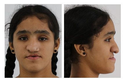 fortune-biomass-feedstock fortune-biomass-feedstock