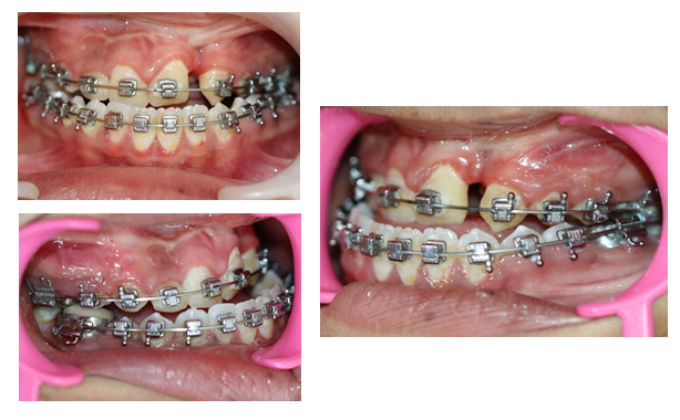 fortune-biomass-feedstock fortune-biomass-feedstock