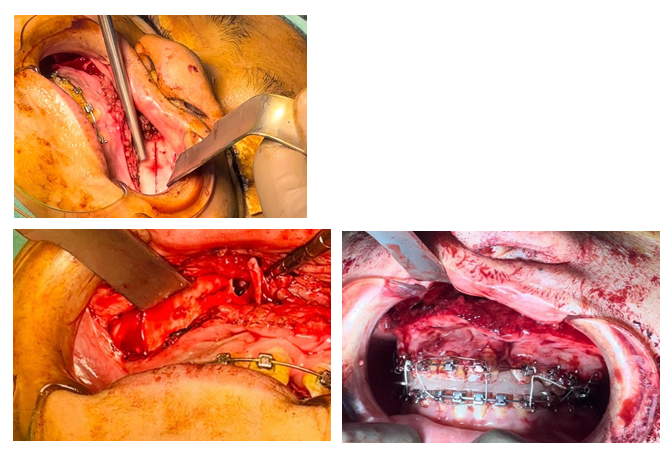 fortune-biomass-feedstock fortune-biomass-feedstock