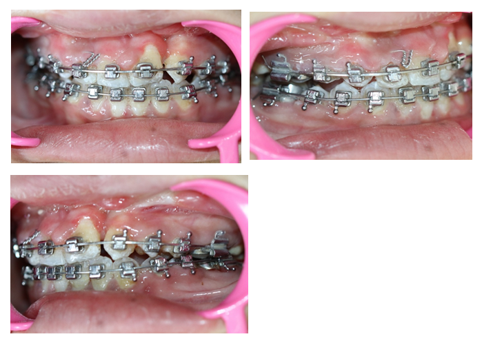 fortune-biomass-feedstock fortune-biomass-feedstock