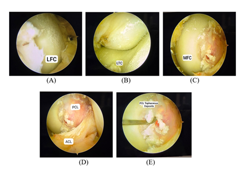 fortune-biomass-feedstock