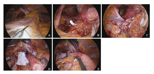 fortune-biomass-feedstock fortune-biomass-feedstock