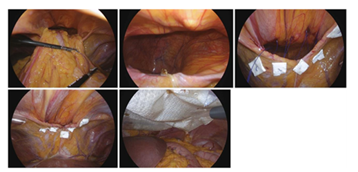 fortune-biomass-feedstock fortune-biomass-feedstock