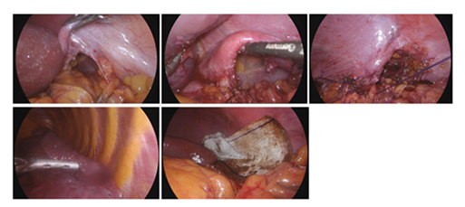 fortune-biomass-feedstock fortune-biomass-feedstock