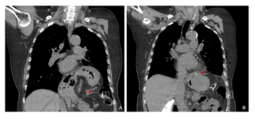 fortune-biomass-feedstock fortune-biomass-feedstock