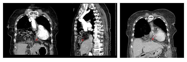 fortune-biomass-feedstock fortune-biomass-feedstock