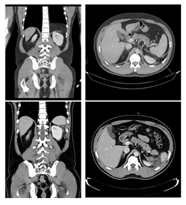 fortune-biomass-feedstock fortune-biomass-feedstock