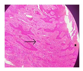 fortune-biomass-feedstock