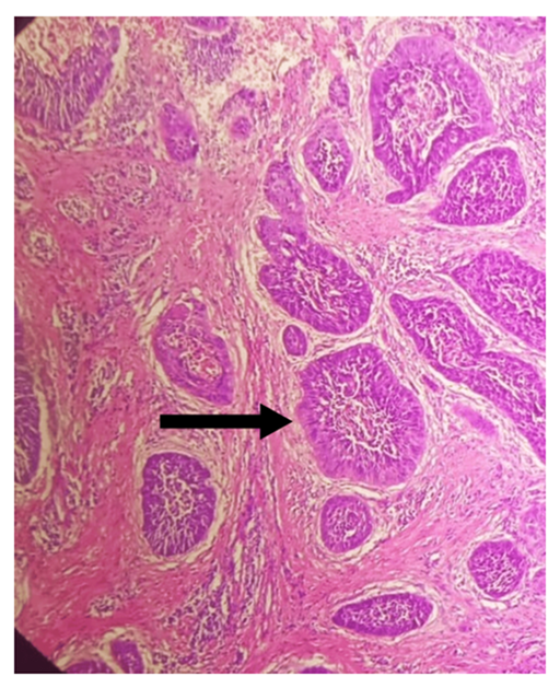 fortune-biomass-feedstock