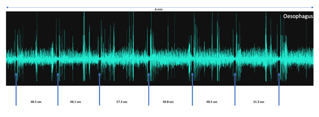 fortune-biomass-feedstock
