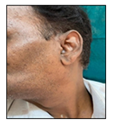 fortune-biomass-feedstock