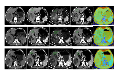 fortune-biomass-feedstock