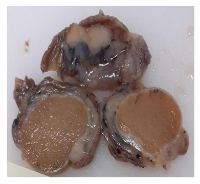 fortune-biomass-feedstock