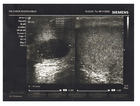fortune-biomass-feedstock