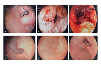 fortune-biomass-feedstock