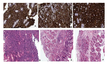 fortune-biomass-feedstock