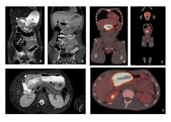 fortune-biomass-feedstock