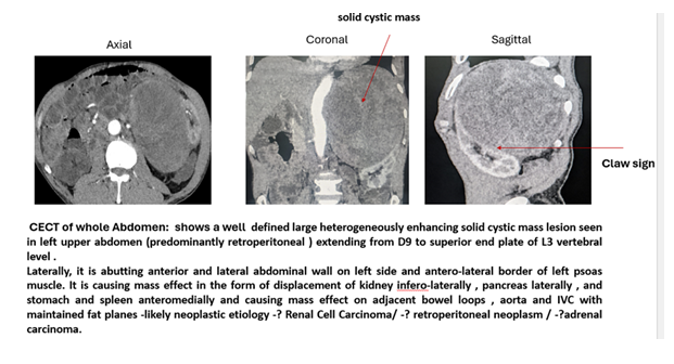fortune-biomass-feedstock
