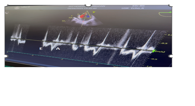 fortune-biomass-feedstock
